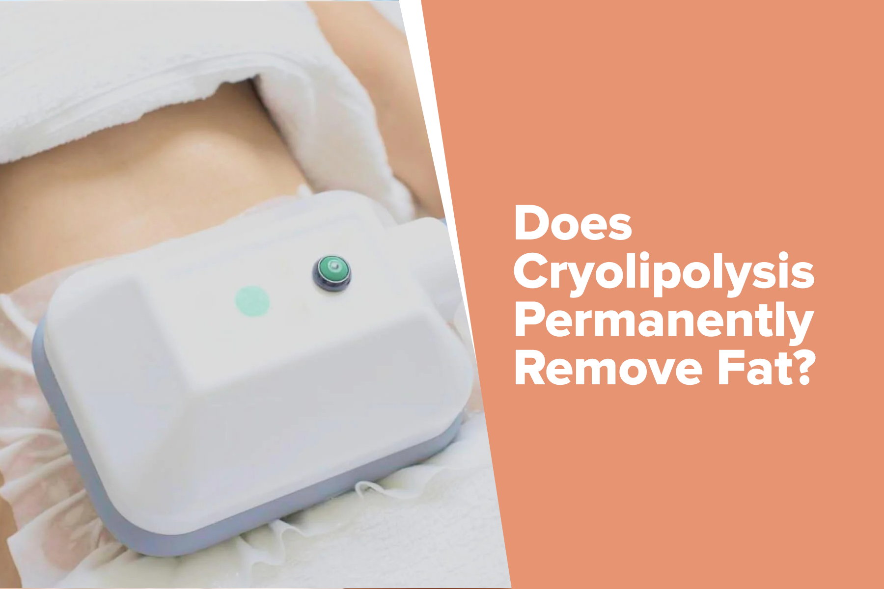 Does Cryolipolysis Permanently Remove Fat?