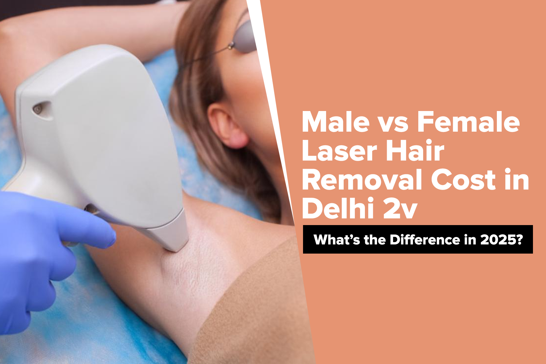 Laser hair removal in Delhi