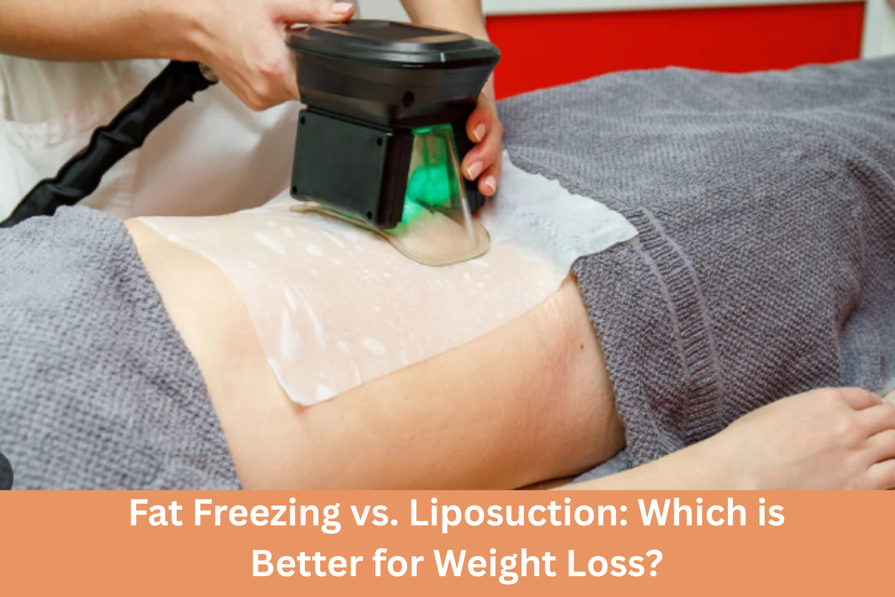fat freezing treatment in Delhi