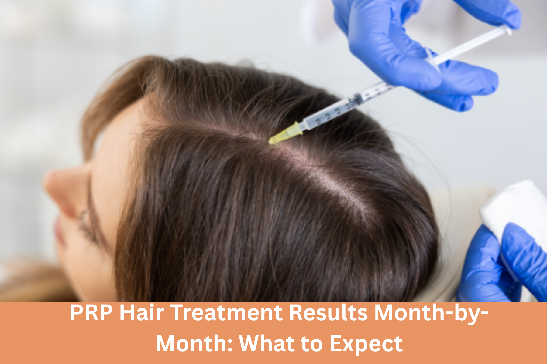 hair prp treatment in Delhi