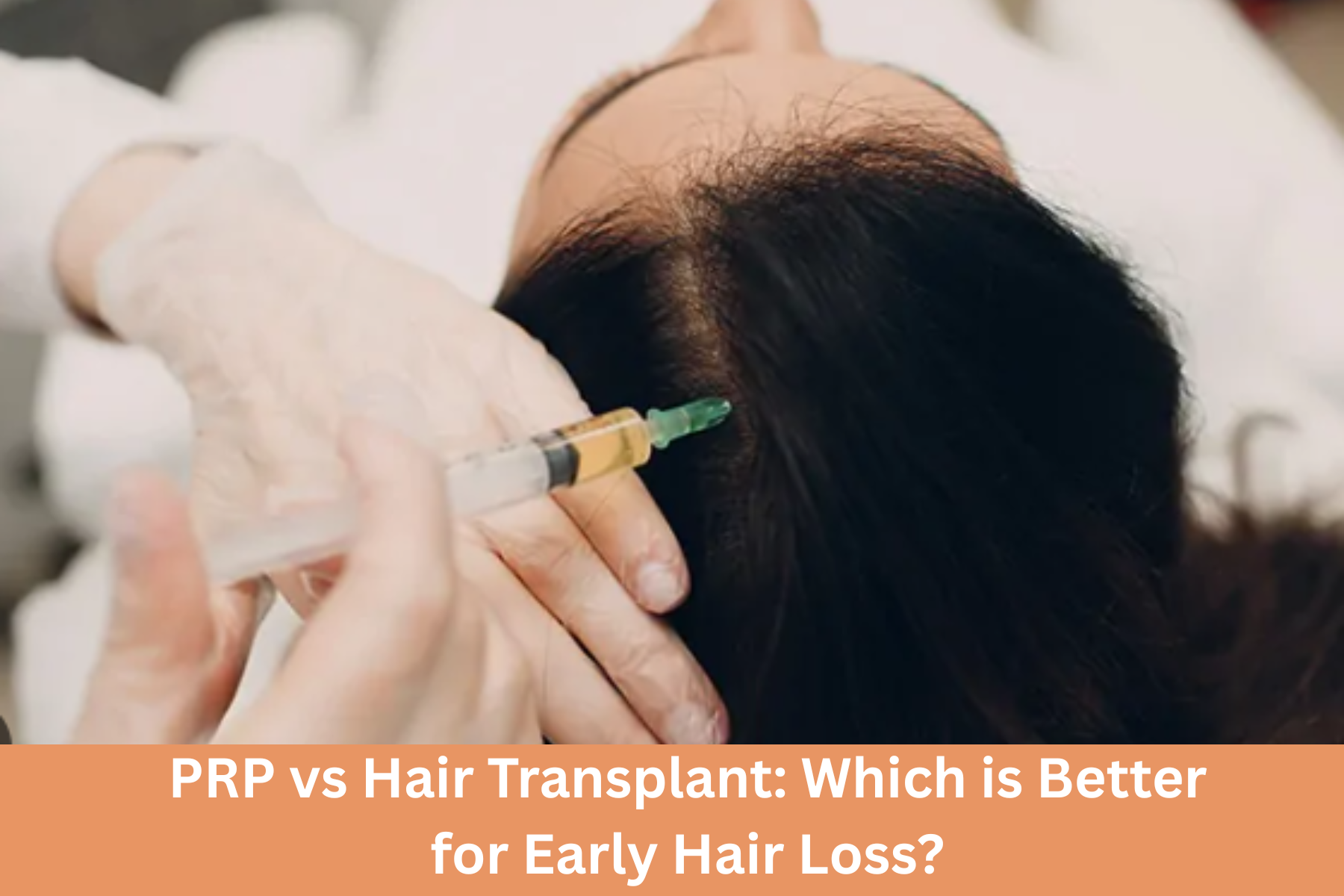 hair prp treatment in Delhi
